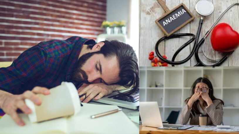 Office Fatigue sign of Anemia