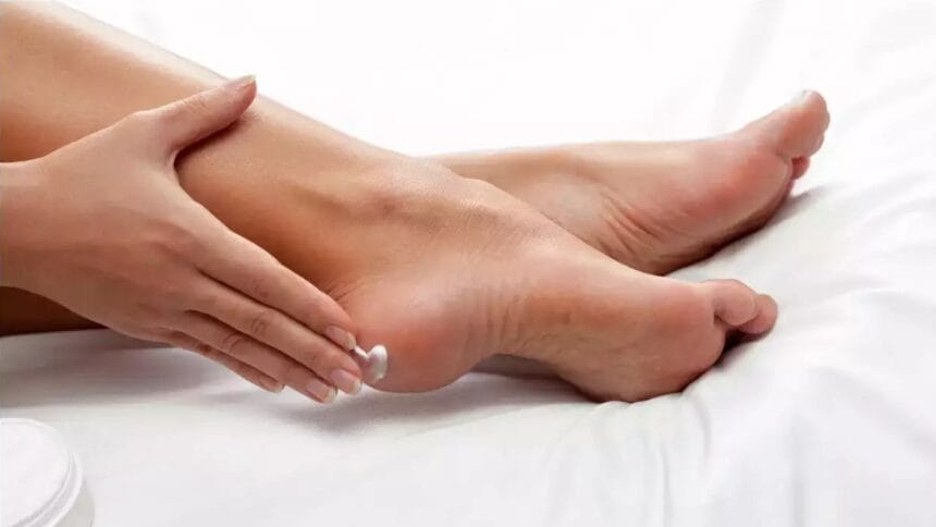 Care for Cracked Heels in Winter